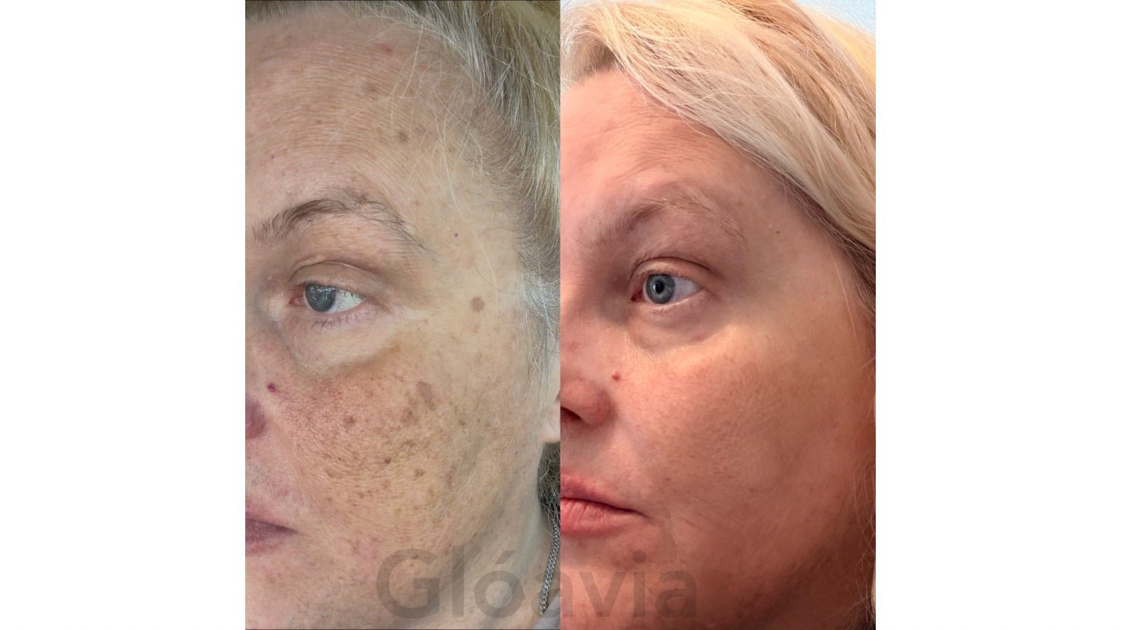 Founder Favorites - Gloavia