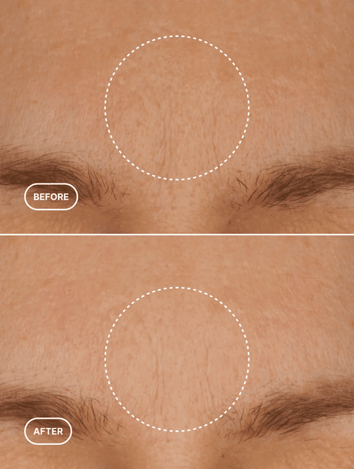 Retinol Alternative Moisturizer - Gloavia